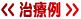 治療例